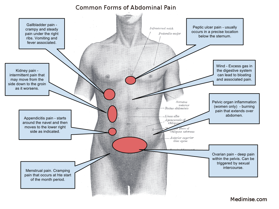 Abdomen inflamado sin dolor
